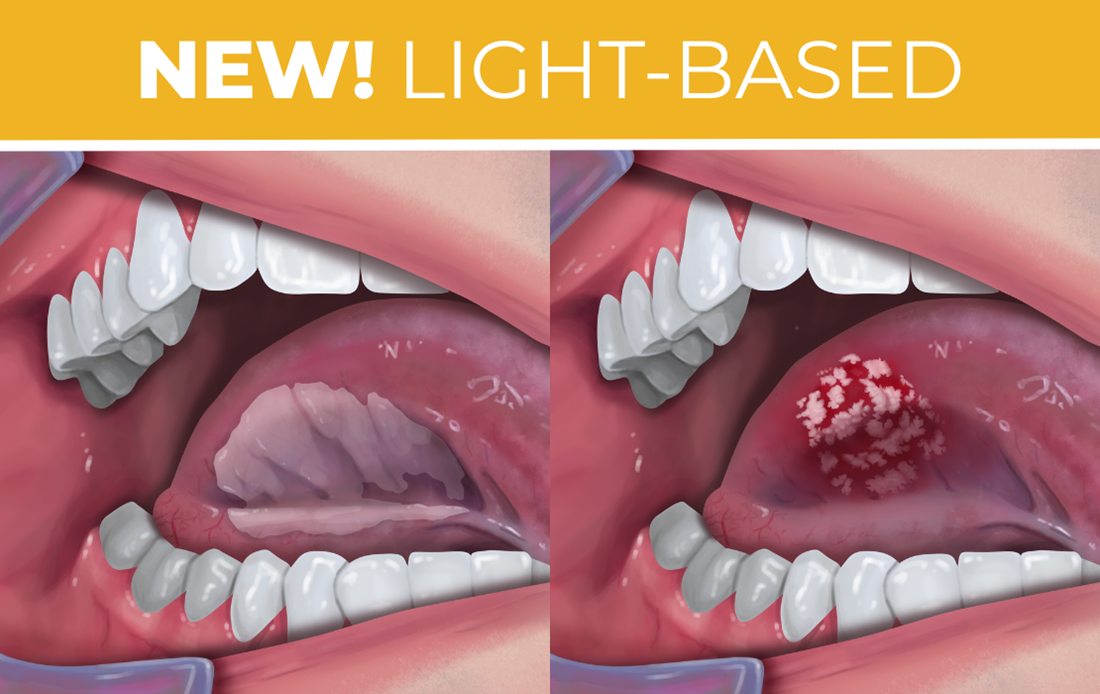 New Light-based